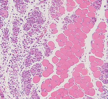 Improve Muscle Regeneration