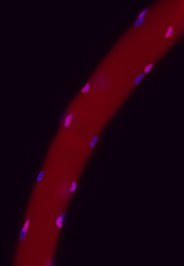 Molecular Regulation of Muscle Stem Cell
